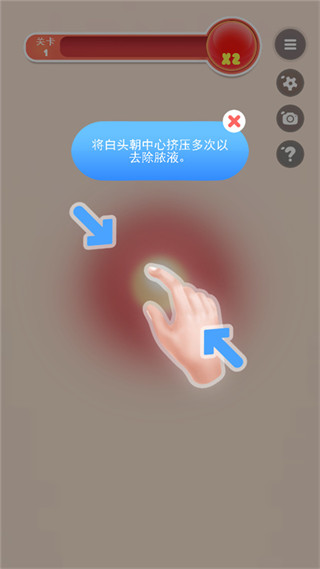 挤痘痘达人2026版下载 挤痘痘达人2026版下载