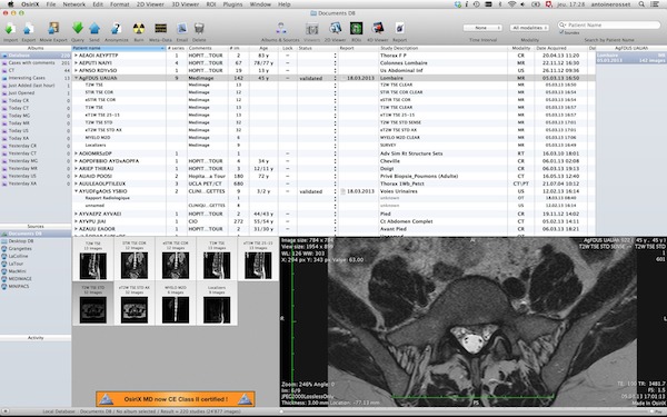 OsiriX for mac(ҽͼ) ٷ6.0.2 °