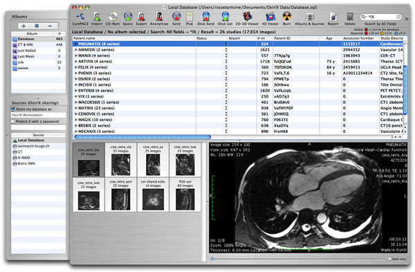 OsiriX for mac(ҽͼ) ٷ6.0.2 °