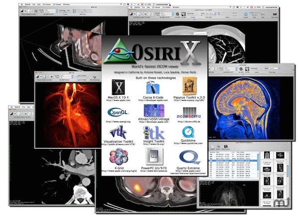 OsiriX for mac(ҽͼ) ٷ6.0.2 °