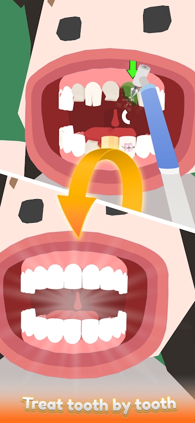 Idle Dentist(空闲的牙医)v0.0.4 安卓版