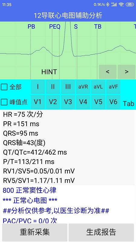 健康2030智能读图心电图系统v1.0.0 安卓版